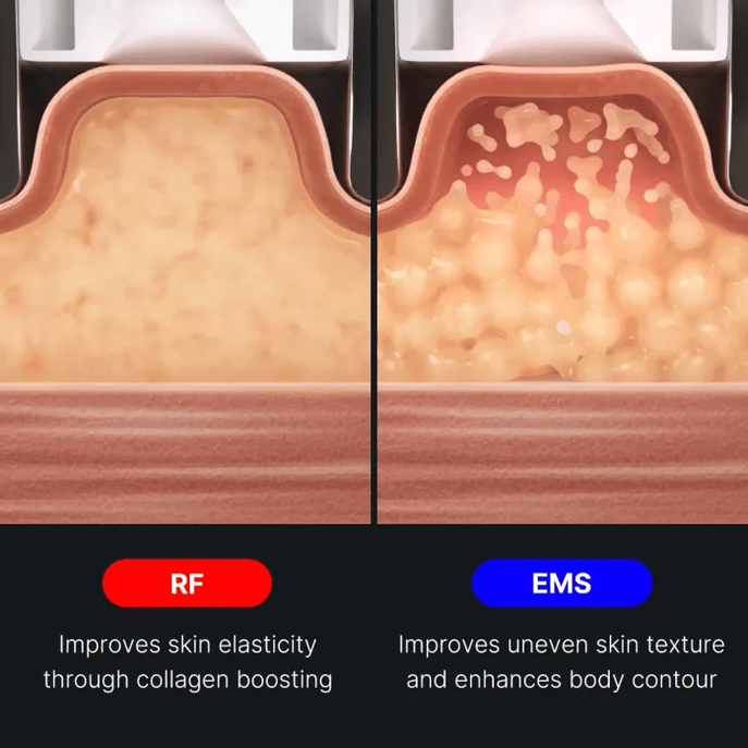 AGE-R Contour Body Shot