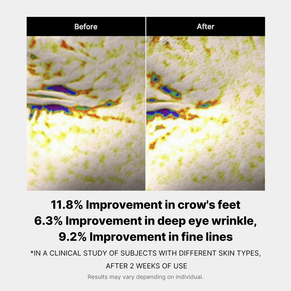 Puffiness Reduction