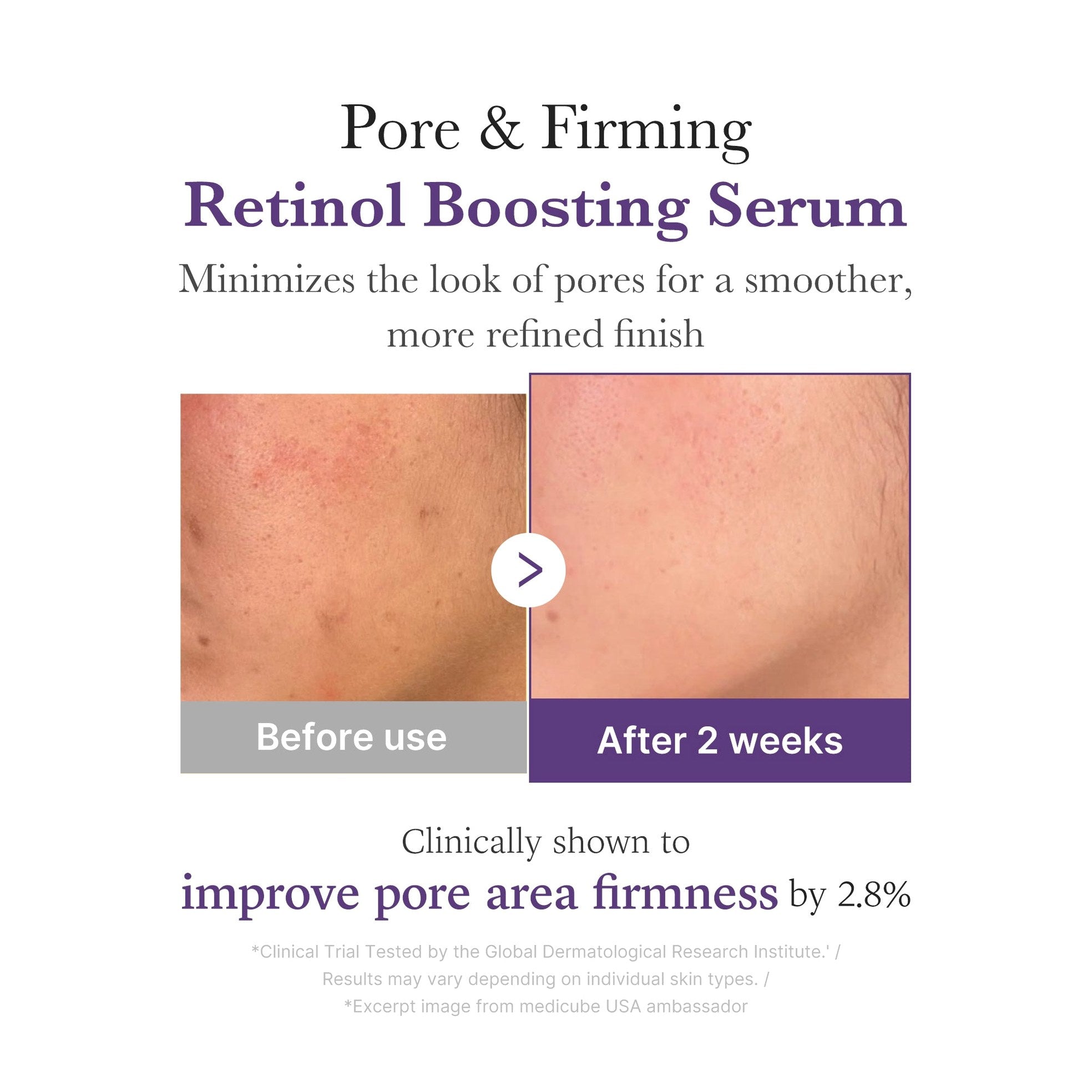 Retinol NMN Boosting Serum